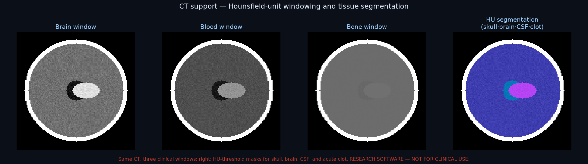 CT support — windowing and segmentation