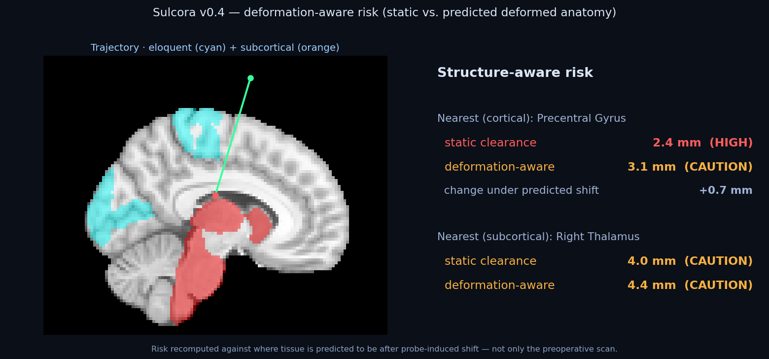 Sulcora deformation-aware risk on a real MRI