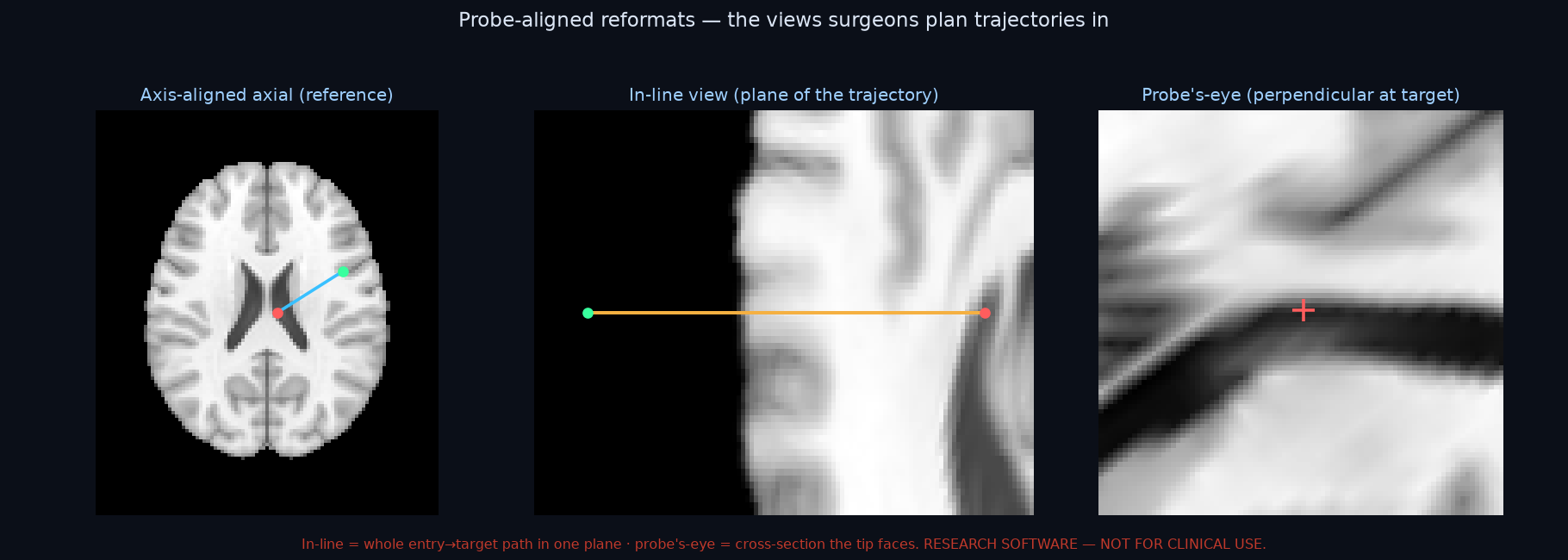 Probe-aligned reformats