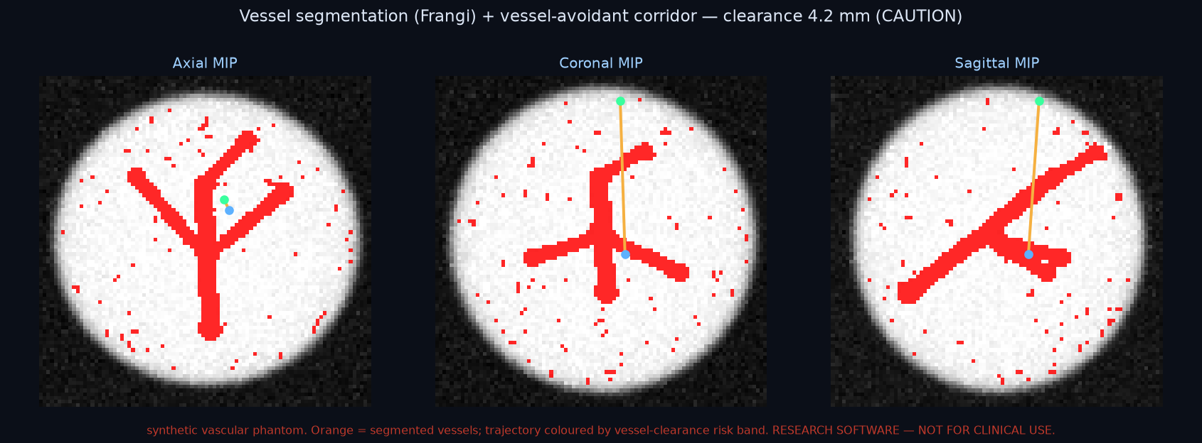 Vessel avoidance